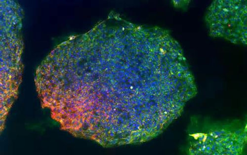 2014你不能錯過的干細胞論文！  